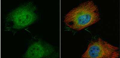 Immunocytochemistry/ Immunofluorescence: T Plastin Antibody [NBP1-32380]