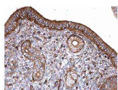 Immunohistochemistry-Paraffin: T Plastin Antibody [NBP1-32380]