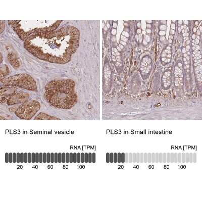Immunohistochemistry-Paraffin: T Plastin Antibody [NBP2-13778]