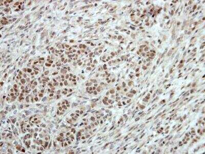 Immunohistochemistry-Paraffin: T-bet/TBX21 Antibody [NBP2-20583]