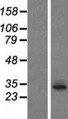 Western Blot: T2R60 Overexpression Lysate [NBP2-05039]