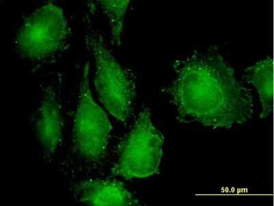Immunocytochemistry/ Immunofluorescence: TAB1 Antibody (2A12) [H00010454-M03]