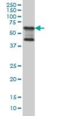 Western Blot: TAB1 Antibody (2A12) [H00010454-M03]