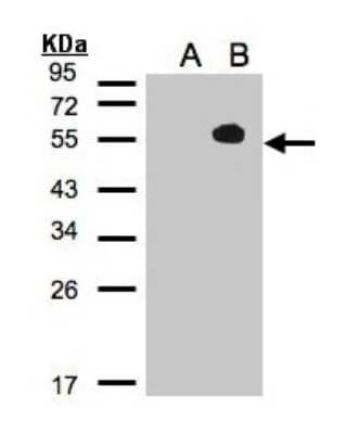 Western Blot: TAB1 Antibody [NBP2-20552]