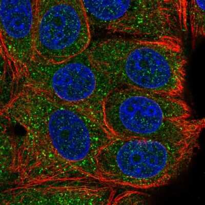 Immunocytochemistry/ Immunofluorescence: TAB2 Antibody [NBP2-56607]