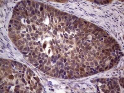 Immunohistochemistry: TACC1 Antibody (OTI1H2) - Azide and BSA Free [NBP2-74429]