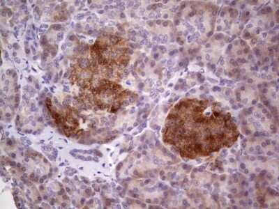 Immunohistochemistry: TACC1 Antibody (OTI1H2) - Azide and BSA Free [NBP2-74429]