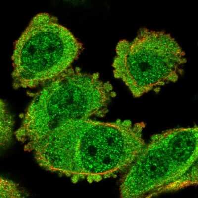 Immunocytochemistry/ Immunofluorescence: TACC2 Antibody [NBP2-57227]