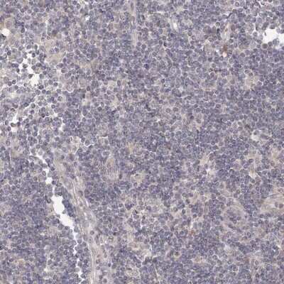 Immunohistochemistry-Paraffin: TACC2 Antibody [NBP2-38173]