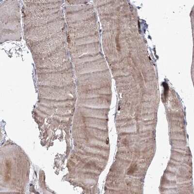 Immunohistochemistry-Paraffin: TACC2 Antibody [NBP2-38173]