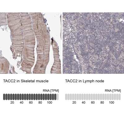 Immunohistochemistry-Paraffin: TACC2 Antibody [NBP2-38173]
