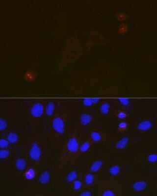 Immunocytochemistry/ Immunofluorescence: TACC3 Antibody (7S7L2) [NBP3-15816]