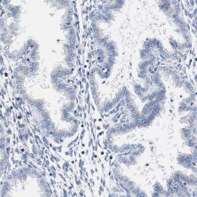 Immunohistochemistry-Paraffin: TACC3 Antibody [NBP1-84810]