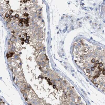 Immunohistochemistry-Paraffin: TACC3 Antibody [NBP1-84810]
