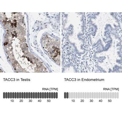 Immunohistochemistry-Paraffin: TACC3 Antibody [NBP1-84810]