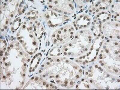 Immunohistochemistry: TACC3 Antibody (OTI6F1) - Azide and BSA Free [NBP2-74436]