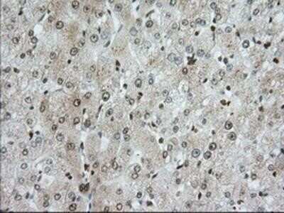 Immunohistochemistry: TACC3 Antibody (OTI6F1) - Azide and BSA Free [NBP2-74436]