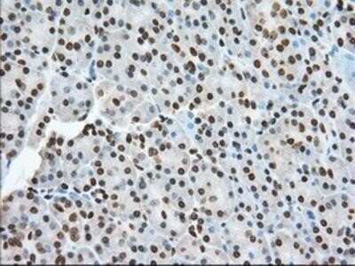 Immunohistochemistry: TACC3 Antibody (OTI6F1) - Azide and BSA Free [NBP2-74436]