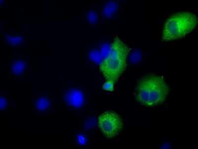 Immunocytochemistry/ Immunofluorescence: TACC3 Antibody (OTI6F1) [NBP2-02619]