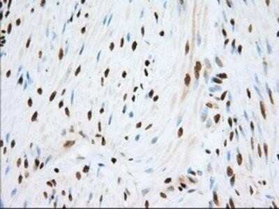 Immunohistochemistry-Paraffin: TACC3 Antibody (OTI6F1) [NBP2-02619]