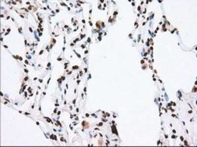 Immunohistochemistry-Paraffin: TACC3 Antibody (OTI6F1) [NBP2-02619]