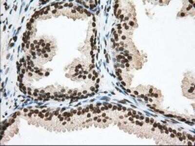 Immunohistochemistry-Paraffin: TACC3 Antibody (OTI6F1) [NBP2-02619]