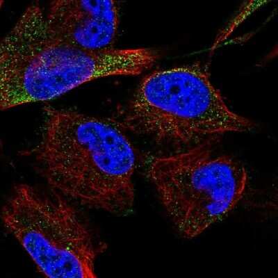 Immunocytochemistry/ Immunofluorescence: TACE/ADAM17 Antibody [NBP2-58422]