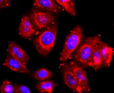 Immunocytochemistry/ Immunofluorescence: TACE/ADAM17 Antibody (JM10-35) [NBP2-67179]