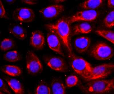 Immunocytochemistry/ Immunofluorescence: TACE/ADAM17 Antibody (JM10-35) [NBP2-67179]