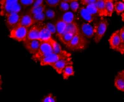 Immunocytochemistry/ Immunofluorescence: TACE/ADAM17 Antibody (JM10-35) [NBP2-67179]