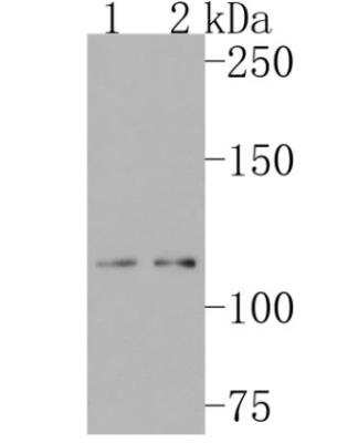Western Blot: TACE/ADAM17 Antibody (JM10-35) [NBP2-67179]