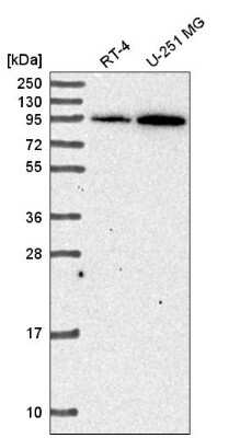 Western Blot: TACE/ADAM17 Antibody [NBP2-58422]