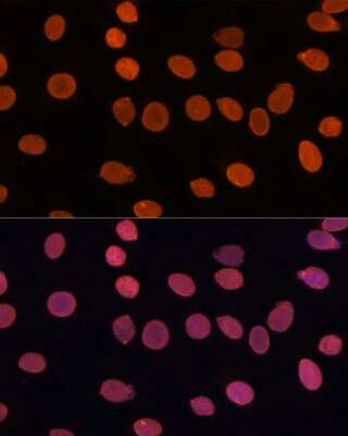 Immunocytochemistry/ Immunofluorescence: TADA3L Antibody - Azide and BSA Free [NBP2-94077]