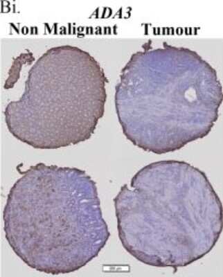Immunohistochemistry: TADA3L Antibody [NBP1-90243]