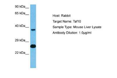 Western Blot: TAF10 Antibody [NBP2-85867]