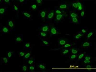 Immunocytochemistry/ Immunofluorescence: TAF11 Antibody (2G9) [H00006882-M04]