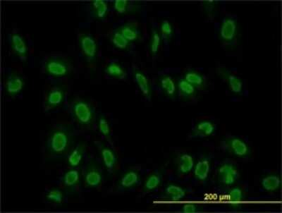 Immunocytochemistry/ Immunofluorescence: TAF11 Antibody (3D3) [H00006882-M01]