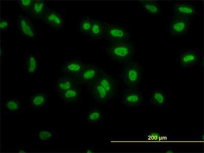 Immunocytochemistry/ Immunofluorescence: TAF11 Antibody (3H5) [H00006882-M03]