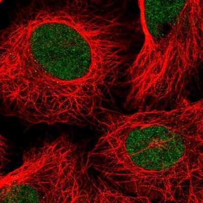 Immunocytochemistry/ Immunofluorescence: TAF11 Antibody [NBP2-55367]