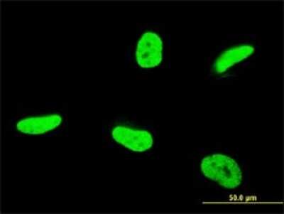 Immunocytochemistry/ Immunofluorescence: TAF12 Antibody (1E10) [H00006883-M11]