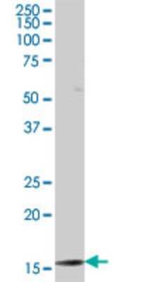 Western Blot: TAF12 Antibody (1E10) [H00006883-M11]