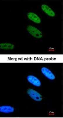 Immunocytochemistry/ Immunofluorescence: TAF15 Antibody [NBP1-32461]