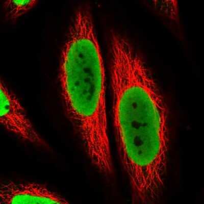 Immunocytochemistry/ Immunofluorescence: TAF15 Antibody [NBP2-57720]