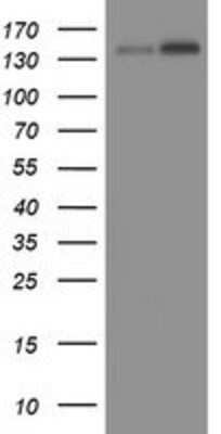 Western Blot: TAF2 Antibody (OTI2A5) [NBP2-01967]
