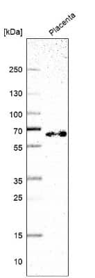 Western Blot: TAF5L Antibody [NBP2-57546]