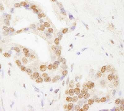 Immunohistochemistry-Paraffin: TAF6 Antibody [NB100-60640]