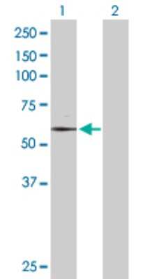 Western Blot: TAF6 Antibody [H00006878-D01P]
