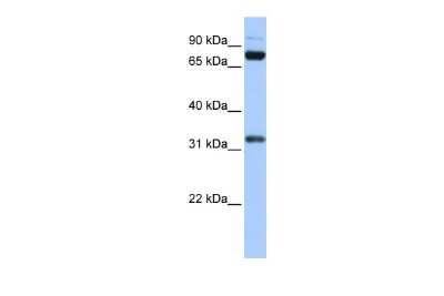 Western Blot: TAF6 Antibody [NBP3-10485]