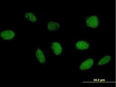 Immunocytochemistry/ Immunofluorescence: TAF6L Antibody [H00010629-B01P]