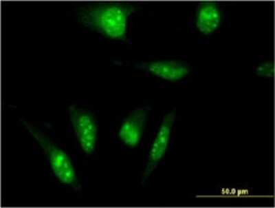 Immunocytochemistry/ Immunofluorescence: TAF7L Antibody (3E10) [H00054457-M04]